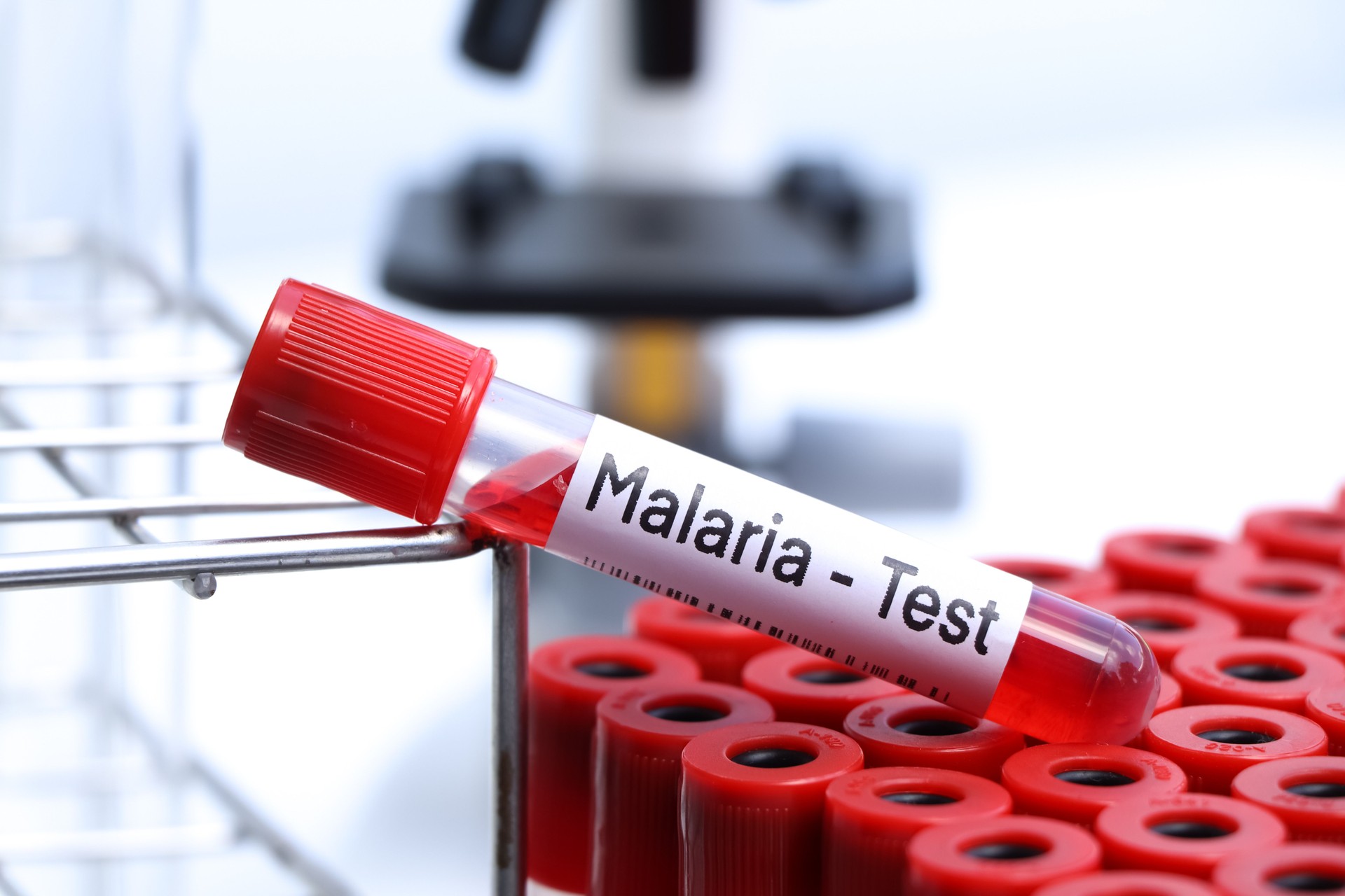 Malaria test to look for abnormalities from blood